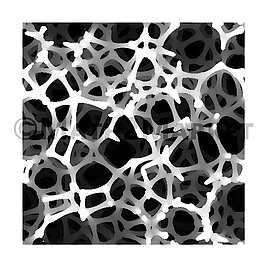 2D SEM view of a open cell foam